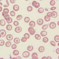 red blood cells